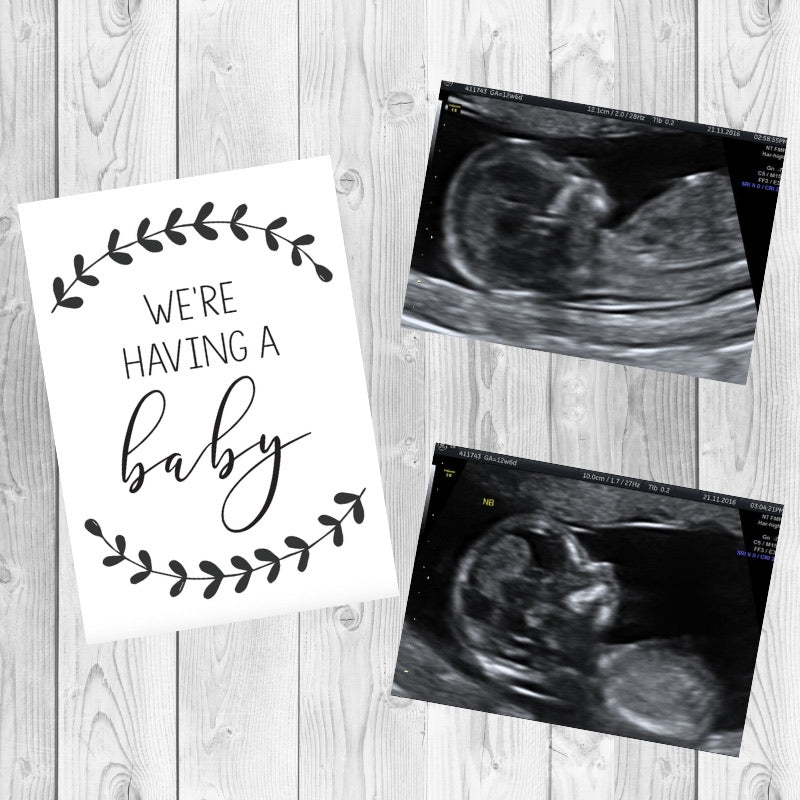 Black and White Pregnancy Milestone Cards