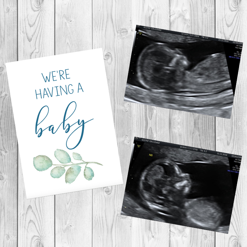 Floral Pregnancy Milestone Cards